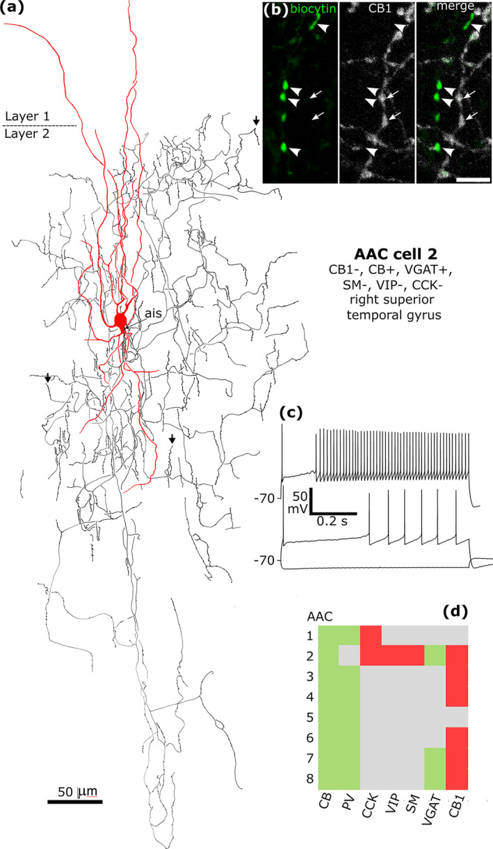 Axo‐axonic cells are immunonegative for CB1 receptor. (a) Reconstruction of the recovered parts of an axo‐axonic cell (No 2 in d) with soma and dendrites (red) and a descending axon (black) with characteristic radially oriented bouton cartridges (vertical arrows), each following the axon initial segment (ais) of a pyramidal cell. The ais originates from the base of the soma. (b) Biocytin labelled boutons (green) were immunonegative for CB1 (arrowheads) in an area of strongly CB1 positive axons (arrows). (c) Voltage responses of the cell to current injections of rheobase, RB + 100 pA (upper trace), and holding current −100 pA; only a very slight voltage sag was detected to the hyperpolarising current injection. The cell fired an initial spike followed by a lag and fast spiking when continuously depolarised, which was characteristic of all eight axo‐axonic cells recorded. (d) Immunoreactivities in all recorded and visualised axo‐axonic cells (n = 8) tested for 2–8 molecules: green, immunopositive; red, immunonegative; grey, not tested/inconclusive. All neurons tested were CB‐, PV‐ and VGAT‐positive, and none of the 6 cells tested showed CB1 immunoreactivity. Scale bars, (a), 50 μm; (b), 5 μm.