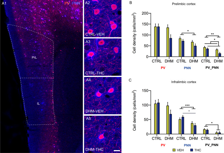 Analysis of the density of PV-immunoreactive neurons and PNNs in PrL and IL cortices.A1, representative confocal images showing the distribution of PV positive cells (red) and PNNs (blue) in the prelimbic (PrL) and infralimbic (IL) cortices. A2–A5 show in detail the co-localization between PV-expressing cells and PNNs. The histogram in B shows a decrease in the density of PNNs in DHM mice and a decrease in the density of PV+ cells surrounded by PNNs due to model and administration of THC in the PrL cortex after two-way ANOVA analysis. The histogram in C shows a decrease in the density of PNNs in DHM mice and a decrease in the density of PV_PNNs in DHM mice in the IL cortex after two-way ANOVA analysis. Black asterisks and lines in graphs represent main effects after two-way ANOVA analysis and grey symbols and lines represent statistically significant differences among groups after post hoc analyses, p < 0.05 (*), p < 0.01 (**), p < 0.001 (***). The columns represent the mean ± S.E.M of cell density (cells/mm2). Scale bar: 87 μm for A1; detailed view (A2–A5), 13.5 μm. n = 6 animals/group.