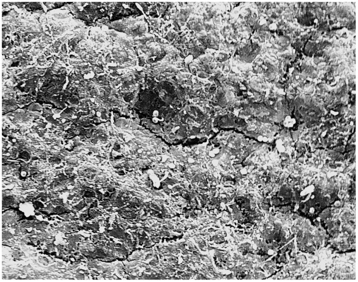 Aortic root arterial wall (Thawing protocol 1)—Loss of the endothelium exposing the basal lamina, damage to the subendothelial layers with randomly dispersed circular defects and micro-fractures.(Magnification- 560x).