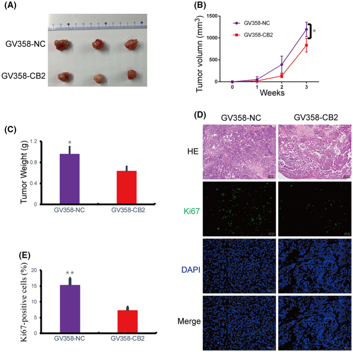 CB2 inhibited the tumorigenesis of BC cells in vivo. (A) Representative images of tumor size are shown. (B) Tumor volumes were measured on the 1, 2, 3 week. (C) Tumor weights for each group. (D and E) HE staining and immunohistochemistry expression of Ki67 in tumors of nude mice (scale bar: 200 μm, 100×; 50 μm, 400×). Data presented as mean ± SD, *p < 0.05, **p < 0.01.