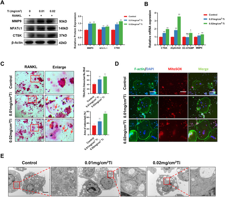 Ti particles promoted the activation of osteoclasts and the formation of superoxide in mitochondria.A The expression and quantitative analysis of MMP9, NFATc1, and CTSK were detected by western blotting after treatment with RANKL and Ti particles. B qRT-PCR analysis of the mRNA expression levels of CTSK, Atp6v0d2, DC-STAMP, and MMP9. C TRAcP staining and quantitative analysis of the number of positive osteoclasts and the percentage of osteoclasts in the area. Scale bars, 100 µm. D The expression of superoxide in osteoclasts was detected by MitoSOX immunofluorescence staining. Scale bars, 100 µm. E The microstructure under TEM after intervention with Ti particles. Scale bars, 2 µm. The data were represented as mean ± SD of three independent experiments. Statistical significance was determined by a one-way ANOVA with Tukey’s multiple-comparison test. *P < 0.05, **P < 0.01.