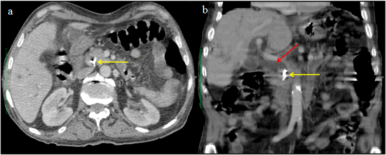 Fig. 1