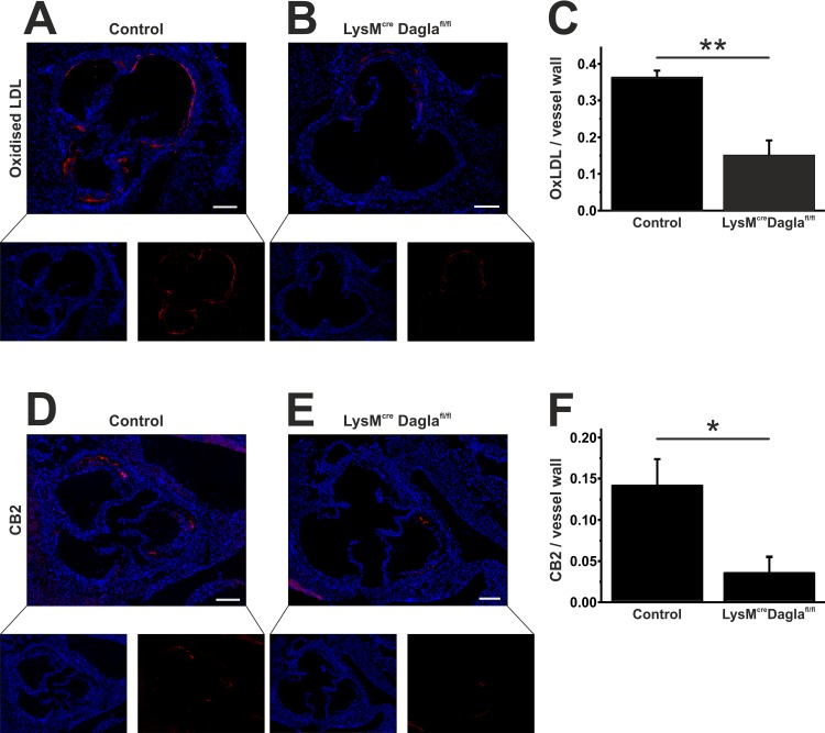 Assessment of oxLDL and CB2 within atherosclerotic lesions.Frozen sections through the aortic sinus of both control mice and Dagla-deficient mice were stained for oxLDL. OxLDL formation was predominant in the endothelium and within atherosclerotic plaques (A, B). OxLDL formation was significantly diminished in Dagla-deficient mice (C). Staining for CB2 revealed a significantly reduced CB2 expression within the aortic sinus (D-F). Data are presented as mean ± standard error of the mean; n = 3–5; *, p < 0.05; **, p < 0.01. Scale bar, 200 μm. CB2, cannabinoid receptor 2; Cre, cyclisation recombination; Dagla, diacylglycerol lipase α; fl, flanked by loxP; LDL, low-density lipoprotein; LysM, lysozyme 2 gene.
