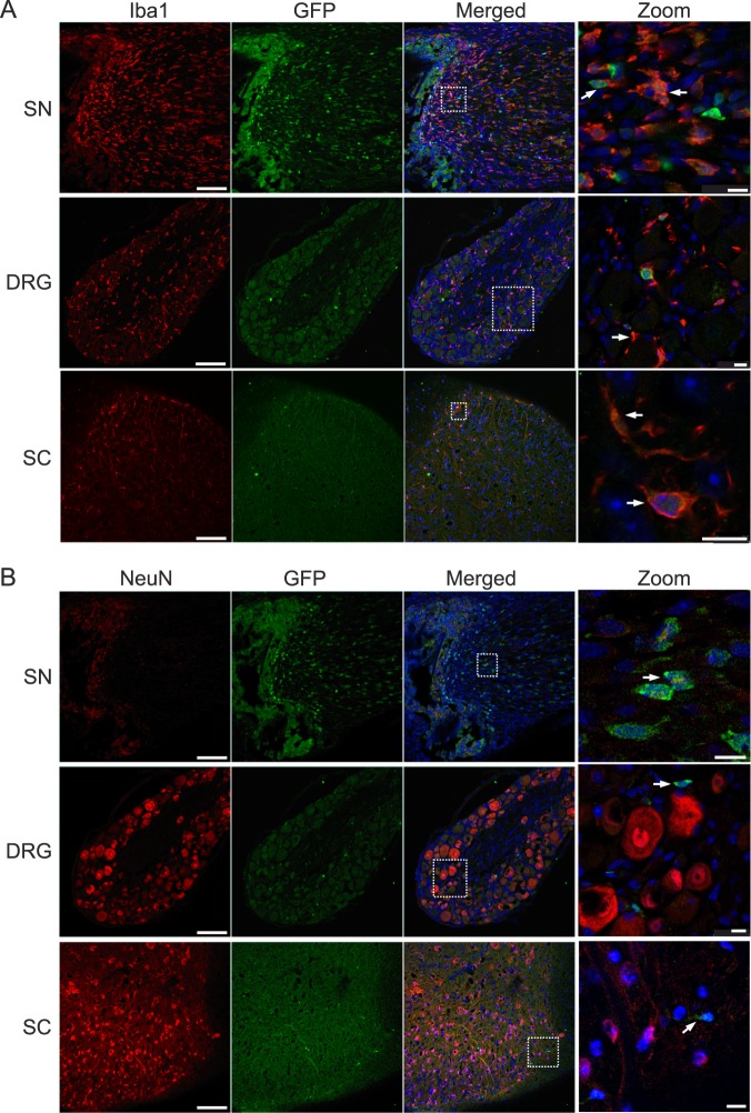 Coexpression of GFP with Iba1 (A) and NeuN (B). Representative staining of ligated GFP-CB2 14 days post SNL in ipsilateral sciatic nerve (SN), ipsilateral dorsal root ganglion (DRG), and ipsilateral dorsal horns of the lumbar spinal cord (SC). GFP (green) colocalized with Iba1 (red, A) but not with NeuN (red, B). Arrows show coexpressing cells (scale = 100 µm, zoom scale = 10 µm).
