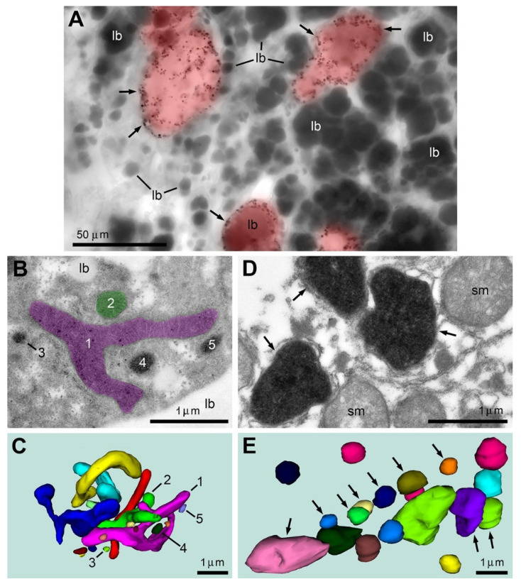 Immunolabeling using CB1R-L31 serum identifies SLP2-like type 2 immunopositive mitochondria and reveals necrosis-like ultrastructural pathology among hepatocytes from aging mice. (A) Representative light micrograph shows numerous type 2 mitochondria (arrows) in a fraction of hepatocytes (highlighted red) in the liver of a 16-month-old mouse. Numerous big lipid bodies (lb) are characteristic for hepatocytes. (B,C) Hepatocytes containing only immunonegative mitochondria demonstrate generally normal ultrastructure of organelles and high variability of mitochondrial shape although all mitochondria show well-developed crista and dense matrix. For example, mitochondria #1 and #2, correspondingly colored magenta and green in the electron micrograph (B) and 3D reconstruction from serial sections (C), show elongated and branching shapes. Mitochondria #3–5 are small and spherical. (D,E) Type 2 mitochondria-containing cells from the same sample reveal fission and swelling of all mitochondria. Other organelles are hardly identifiable in the type 2 mitochondria-containing cells demonstrating their necrosis-like ultrastructural pathology. Type 2 mitochondria are indicated with arrows in the electron micrograph (D) and the 3D reconstruction (E); immunonegative swollen mitochondria (sm) are not pointed in the 3D image. Distinct mitochondria are depicted in different colors in the 3D images (C,E).