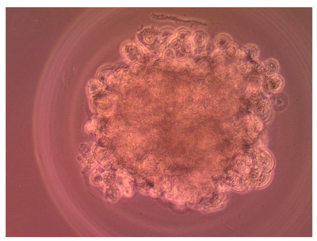 Microscopy image of 3D cultured MCF-7 cells after 7 days after seeding.