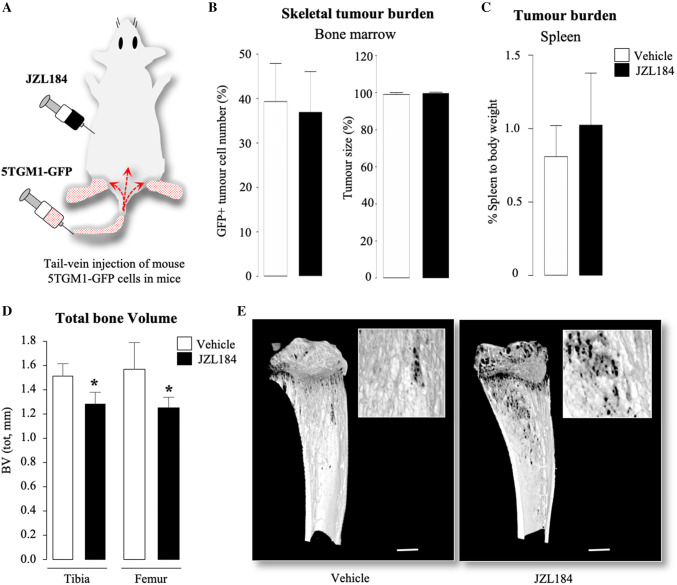 JZL184 induces bone loss without affecting tumour growth in mice bearing MM. a Graphic representation of tail-vein injection of mouse 5TGM1-GFP MM cells (106 cells/mouse) into 8-week-old adult C57BL/6KalWRij mice treated with vehicle (0.01% DMSO) (n = 8 per group) or JZL184 (16 mg/kg, thrice-weekly) (n = 8) for 21 days. b Skeletal tumour burden as assessed by flow cytometry (left) and histological (right) analysis of GFP positive 5TGM1 MM cells in bone marrow (n = 8 per group), and presented as percentage of total cell count. c Tumour burden in spleen presented as percentage of spleen to body weight (n = 8 per group). d Total bone volume (BV, tot) at the tibia and femur of mice (n = 8 per group) from the experiment described in panels a–c, as assessed by microCT. e Representative photomicrographs of microCT scan of the tibial metaphysis of mice from the experiment described in panels a–d at low and high power (scale bar = 1 mm). Values are mean ± SD; *p < 0.05 versus vehicle
