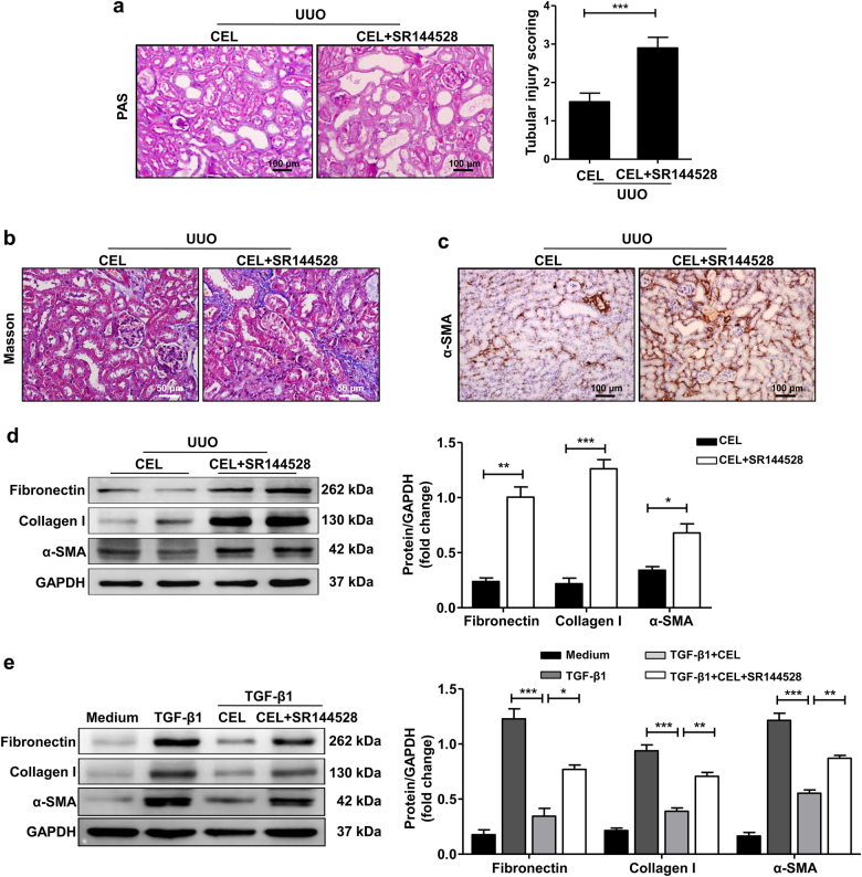 CB2R antagonist SR144528 abolishes anti-renal fibrosis effects of celastrol.a–d Mice were treated with celastrol (1 mg/kg) by intraperitoneal injection immediately after UUO surgery. The celastrol+SR144528 group was additionally pretreated with SR144528 (1 mg/kg) 1 h before the celastrol injection. Both celastrol and SR144528 were administered daily. Mice were killed 7 days after UUO and kidney tissues were collected. a Representative micrographs show kidney injury using PAS staining and quantification of tubular injury scoring in different groups of mice. Bar = 100 μm. b Masson’s trichrome staining of kidney tissues sections. Bar = 50 μm. c Representative micrographs of the expression and distribution of α-SMA in kidney tissues using immunohistochemical staining. Bar = 100 μm. d Western blot analyses of renal fibronectin, collagen I, and α-SMA protein in kidney tissues. Representative western blot and quantitative data were presented. e Serum-starved HK-2 cells were pretreated with or without celastrol (500 nM) for 1 h and then stimulated with TGF-β1 (10 ng/ml) for 24 h. The celastrol+SR144528 group was additionally pretreated with SR144528 (1 μM) 30 min before the celastrol administration. Representative western blot analysis and quantification of fibronectin, collagen I, and α-SMA protein expression in HK-2 cells were presented. The medium group was used as the control for TGF-β1 treatment. Results are representative of three replicate experiments. All values are represented as mean ± SEM. n = 5 /group. *P < 0.05, **P < 0.01, and ***P < 0.001