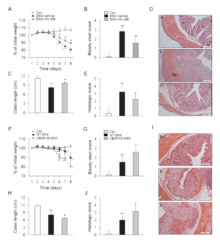 CB2R activation ameliorates the symptoms and colon inflammation in DSS-induced colitis mice.C57BL/6 mice were treated with vehicle or HU 308 (1 mg/kg, i.p.) once a day from day 0 to day 8 while receiving 3% DSS, the control mice were given tap water. In another set of experiments, WT and CB2R KO mice received 3% DSS for 8 days, the control mice were given tap water. Body weight, the presence of occult or gross blood per rectum, and stool consistency were determined by two investigators blinded to the treatment groups. Postmortem, the colon was removed and pieces of colonic tissue were used for ex vivo analysis. Treatment of HU 308 significantly reduced body weight loss (A), bloody stool score (B), increment of colon length (C) and alleviated colon inflammation (D-E). n = 7 per group. **P<0.01 vs. the control group; #P<0.05 vs. the DSS + vehicle group, ##P<0.01 vs. the DSS + vehicle group. Compared with WT group, body weight loss (F), bloody stool score (G), reduction of colon length (H) and colon inflammation (I-J) were significantly increased in CB2R KO group. n = 10 per group. **P<0.01 vs. the control group; #P<0.05 vs. the WT DSS group, ##P<0.01 vs. the WT DSS group.