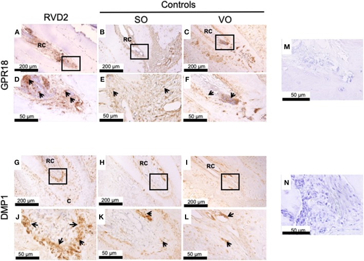 Immunohistochemical analysis. (A) GPR18 protein expression in the root canal of the treatment group. (B,C) GPR18 protein expression in the root canal of the control groups. (D–F) High magnification views of the solid inset in the panels (A–C), respectively. (G) DMP1 protein was abundantly expressed in the root canals of the treatment group. (H,I) Whereas, DMP1 protein expression was lower in the root canal of the control groups as compared to RvD2 group. (J–L) High magnification views of the solid inset in the panels (G–I), respectively. Images are representative for 5 experiments from Group #1 and 3 experiments from Group #2. (M) Negative control without primary antibody GPR18. (N) Negative control without primary antibody DMP1. RC, root canal; C, cementum. The arrow head indicates GPR18 and DMP1 positive expression.