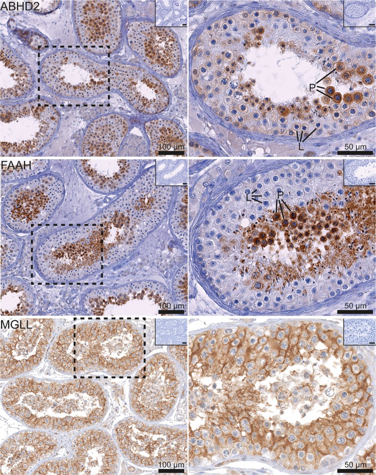 Immunohistochemical staining for the EC-degrading enzymes ABHD2, FAAH and MGLL in the human testis. The images on the left show a general expression pattern and the images on the right show a higher magnification of an area within a stippled line. All pictures show a low magnification image of negative controls in the right upper corner. Note that the ABHD2 (top images) is expressed in the cytoplasm of all stages of germ cell maturation, except early spermatocytes. FAAH reaction (middle row) is strongest in post-meiotic germ cells, including late spermatocytes and spermatids. MGLL protein (bottom images) is abundant in Sertoli cells. L (leptotene) and P (pachytene) indicate early and late spermatocytes, respectively.