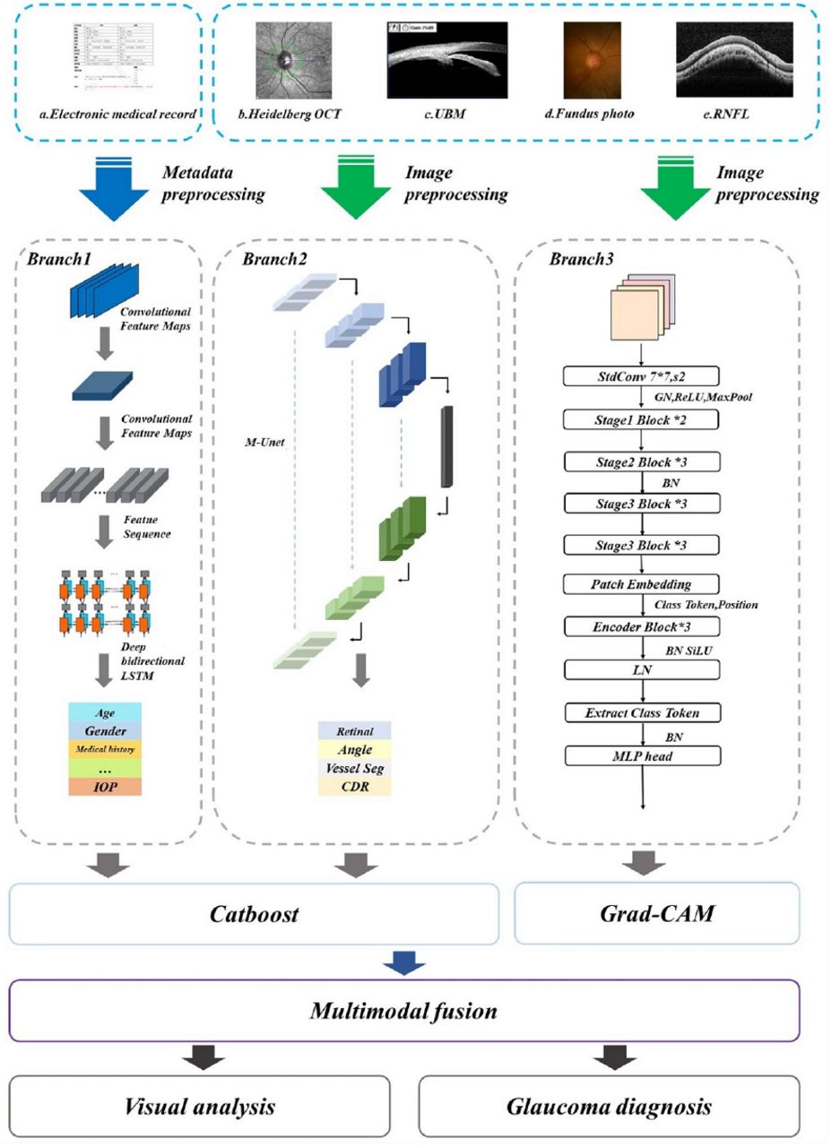 Grad-CAM based Glaucoma Multimodal Neural Network showcasing the use of Grad-CAM [249]. This image is licensed under CC BY 4.0.