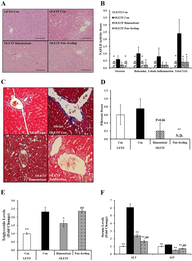Rimonabant improves hepatic steatosis in OLETF rats.(A) Representative hematoxylin and eosin-stained liver sections (scale bars, 200 μm; magnification, 200 X). (B) NAFLD activity score. Representative images of Masson’s trichrome staining (C; scale bars, 100 μm; magnification, 400 X) and fibrosis score (D). Hepatic triglyceride concentrations (E) and serum levels of ALT and AST (F) were expressed as fold change compared to LETO control group (LETO Con). Data are expressed as mean ± SEM (n = 4–5 per group). *P < 0.05, **P < 0.01 compared to OLETF control rats (OLETF con). ##P < 0.01 compared to rimonabant-treated OLETF rats (OLETF rimonabant). N.D., Not detected; NAFLD, Nonalcoholic fatty liver disease; NAS, NAFLD activity score.