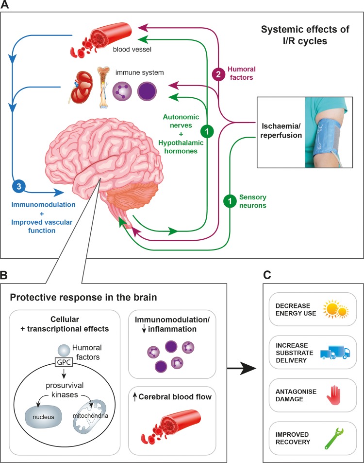 (A) The neuroprotective mechanisms of RIPostC are thought to involve three inter-related pathways induced by remote limb ischaemia. (1) The neuronal pathway involves activation of both local sensory nerves and the autonomic nervous system to mediate protective effects, including the release of humoral factors; (2) the humoral pathway involves endogenous protective factors, including locally acting autocoids and bloodborne humoral factors that travel to the brain and (3) the systemic response includes immune modulation and blood pressure regulation. (B) Within the brain, the three pathways converge to increase cerebral blood flow, ameliorate neuroinflammation and to activate cell survival mechanisms. Direct pro-survival actions within cells are mediated via G-protein-coupled (GPC) receptors and include mitochondrial protection (maintenance of potassium-sensitive ATP channel, prevention of mitochondrial permeability transition pore opening) and transcriptional regulation (both genetic and epigenetic modulation) in the nucleus. (C) Following remote ischaemic stimulus after HI, the effects of these neuroprotective mechanisms are to decrease energy consumption; to increase substrate delivery and offset cerebral secondary energy failure; to protect against cell death and to augment long-term recovery and repair. HI, hypoxia-ischaemia; I/R, ischaemia/reperfusion; RIPostC, remote ischaemic postconditioning.