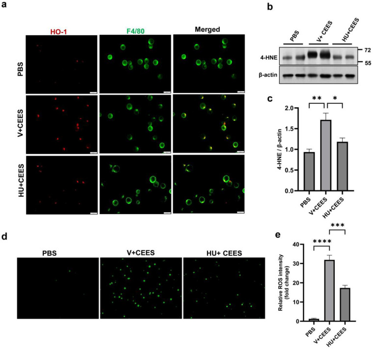 HU308 treatment reduces CEES-induced oxidative stress. AMs were isolated from WT mice, cultured, and exposed to CEES for 4 h. (a) Representative immunostaining image of HO-1 (red) in AMs. F4/80 staining (green) was used to indicate AMs. C57BL/6J WT mice were exposed to either PBS (control) or CEES with or without HU308 treatment, and 4-HNE levels in the lung were examined via immunoblotting. A representative immunoblot image is shown in panel (b), and densitometry data are presented in panel (c). n = 5. Representative DCFH-DA staining of ROS (d) and quantitative analysis (e) in AMs exposed to CEES with or without HU308 treatment. n = 5–6, * p < 0.05, ** p < 0.01, *** p < 0.001, **** p < 0.0001. Data are presented as the mean ± SEM. V: vehicle, HU: HU308.