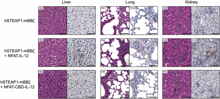 Histological analysis of liver, lung and kidney, related to Fig. 4.Representative H&E and IHC (CD3) staining images from an experiment. Red arrows refer to CD3+ cells. Scale bars, 50 µm.