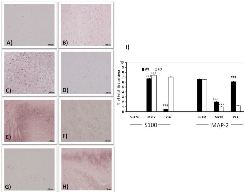 Effects of PEA on alteration of S100β and MAP-2 expression in the SN.A strong increase in S100β-immunoreactive cells was observed in MPTP-injected PPARαWT animals at 8 days (B and I). A stronger increase in number of S100β-immunoreactive cells was evident in PPARαKO (C and I). The absence of PPARα gene alone did not modify the presence of S100β-immunoreactive cells in sham animals (A). PEA reduced the increased expression of S100β-immunoreactive cells in the SN in PPARαWT mice (D and I). In addition, administration of MPTP to PPARαWT mice produced an important loss in MAP-2 expression at 8 days (F and I). The absence of PPARα gene significantly increased the loss of MAP-2 positive cells induced by MPTP (G and I). PEA treatment ameliorated in PPARαWT mice (H and I) the sever reductions in MAP-2 levels. PEA failed to rescue S100 and MAP-2 induced by MPTP injection in PPAR-α KO mice.