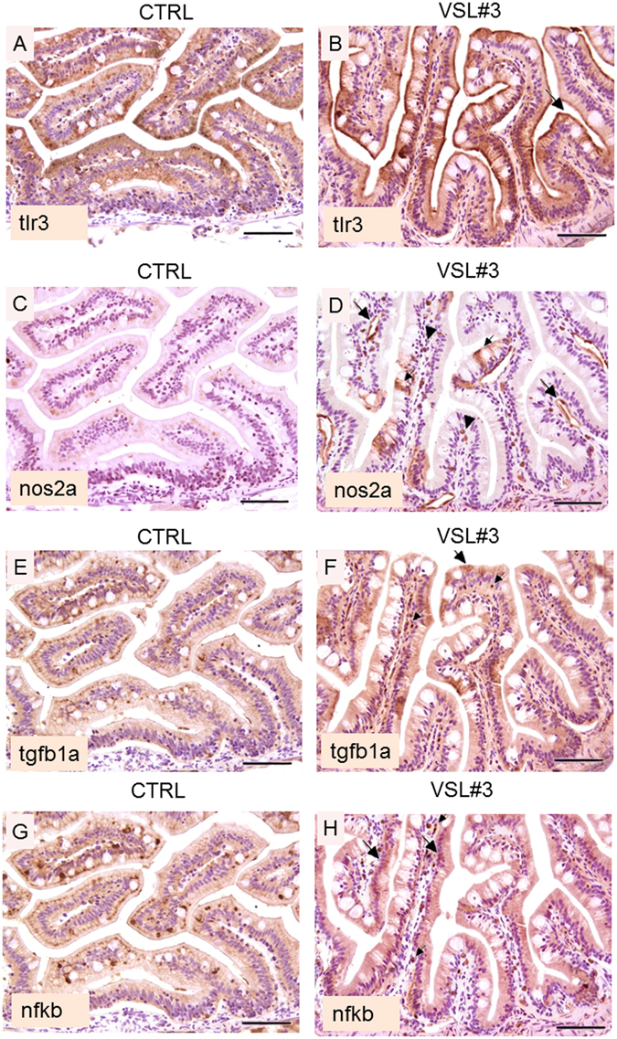(A) Intestine section from untreated fish; note the evident reduction in intensity of tlr3 staining with respect to VSL#3-treated fish, characterized by a weak and irregular enterocyte expression, without any staining of cell free pole membranes (bar = 200 µm). (B) Intestine section from treated fish; note the intense and diffuse presence of tlr3 in the mucosal epithelium. The stain is almost exclusively restricted along the superficial margin of enterocytes (arrow heads), and shows a continuous and constant pattern (bar = 200 µm). (C) In section from untreated fish, note the substantial negativity for the presence of Nos2a, both in the epithelium and in endothelial cells (bar = 200 µm). (D) In intestine section from treated fish, an evident presence of Nos2a is observed, especially in endothelial cells (large arrows) or in scattered mononuclear cells (presumably macrophages) interspersed throughout the mucosal chorion (arrow heads). Note the molecule is also localized in some epithelial cells (small arrow); (bar = 200 µm). (E) Untreated zebrafish show low level of immunoreactivity for Tgfb1a both in the epithelium and in mononuclear cells (bar = 200 µm). (F) In VSL#3-treated fish, intestinal presence of Tgfb1a was strong and diffuse throughout the epithelium (large arrows) and in some mononuclear cells (small arrows); (bar = 200 µm). (G) In untreated fish the localization of the p65 subunit of the Nfkb heterodimer is restricted to scattered epithelial cells (bar = 200 µm). (H) Similarly to Tgfb1a localization, the p65 subunit of the Nfkb heterodimer is present in a large proportion of enterocytes (large arrows). Also note the presence of this marker in many mononuclear cells (small arrows), infiltrating the lamina propria of the intestinal mucosa of VSL#3-treated zebrafish (bar = 200 µm).
