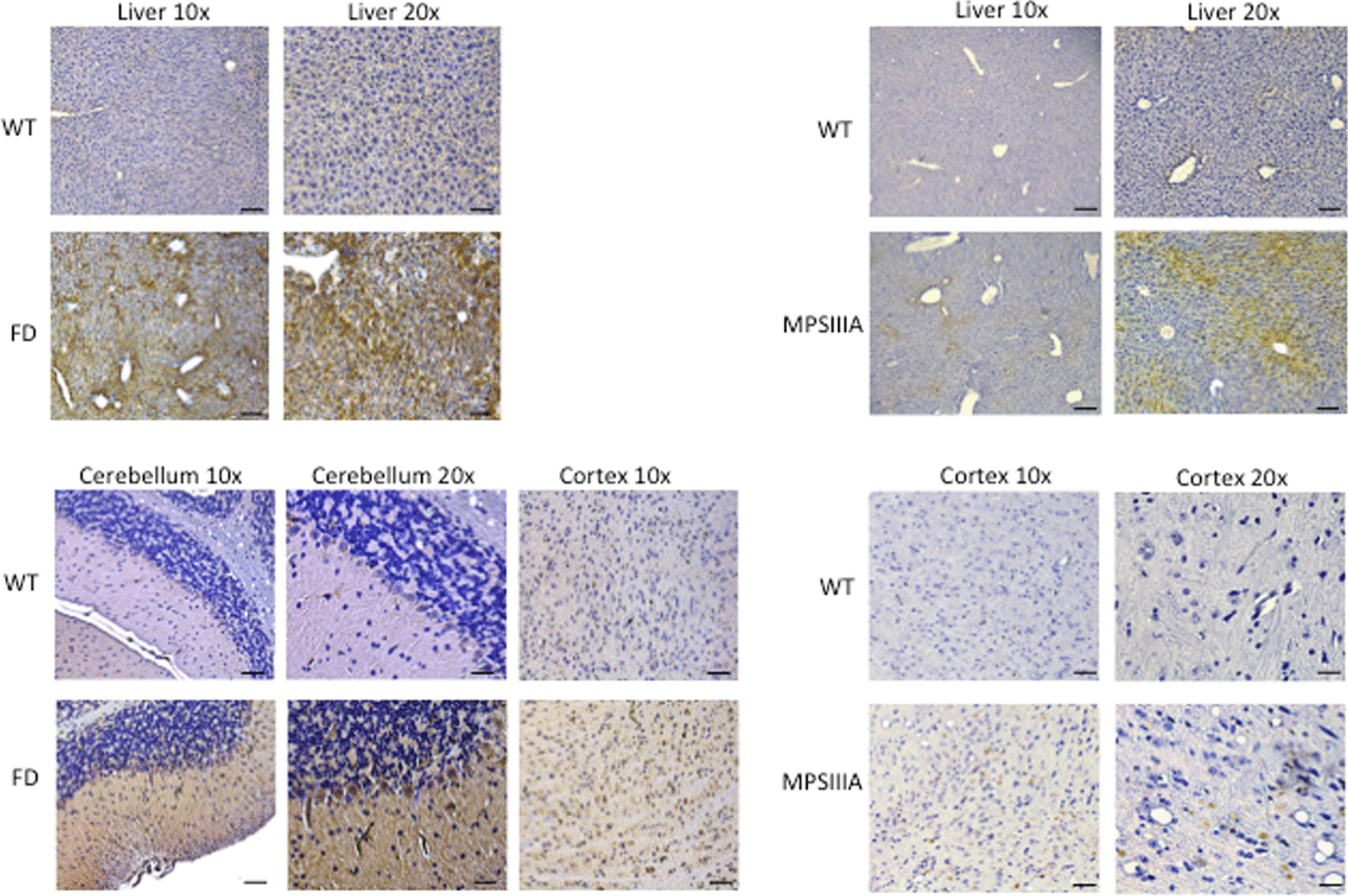 CB2 expression in tissues from Farber and MPS IIIA mice. CB2 is markedly overexpressed in the liver and CNS of mice with Farber disease and MPS IIIA. WT, wildtype; FD, Farber. Brown color indicates staining with CB2 antibodies. Blue color indicates cell nuclei. Bars = 50 µm