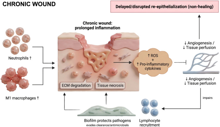 Schematic representation of the pathological course of a chronic wound. Chronic wounds are characterized by a prolonged and amplified inflammatory phase, with excessive infiltration of neutrophils and pro-inflammatory (M1) macrophages. This sustained immune activation leads to elevated production of reactive oxygen species (ROS) and pro-inflammatory cytokines, which collectively impair angiogenesis and tissue perfusion, contributing to necrosis and delayed or disrupted re-epithelialization. Persistent inflammation is further reinforced by lymphocyte recruitment and the presence of biofilms, which protect pathogens from host immune responses and antimicrobial therapies. The figure illustrates the key cellular and molecular features that perpetuate chronic inflammation, ECM degradation, and impaired tissue repair in nonhealing wounds. Created in BioRender. de Avila, E. (2026) https://BioRender.com/eedgtyc. License: TF29ED7GCB.