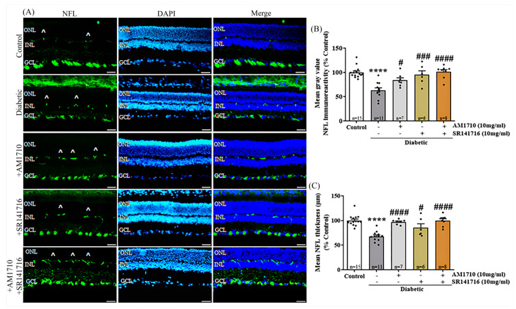 Effect of cannabinoid treatment on ganglion cell axons in the diabetic retina. (A) Representative photomicrographs of NFL immunoreactivity (NFL-IR). Artifacts are depicted by the marker (^). Magnification: 20×. Scalebar: 50 μm. (B) Quantification studies of NFL-IR: Diabetes attenuated NFL-IR (**** p < 0.0001 compared to Control). Both AM1710 and SR141716 reversed the diabetes effect (AM1710; # p = 0.0403 compared to diabetic untreated, p > 0.05 compared to Control, and SR141716; ### p = 0.0008 compared to diabetic untreated, p > 0.05 compared to Control). The dual treatment with AM1710 + SR141716 displayed a similar action by restoring NFL-IR (#### p < 0.0001 compared to diabetic untreated, p > 0.05 compared to Control, p > 0.05 compared to AM1710 or SR141716. (C) Diabetes induced a significant decrease in NFL thickness (**** p < 0.0001 compared to Control). AM1710 and SR141716 reversed the diabetes effect (AM1710; #### p < 0.0001 compared to diabetic untreated, p > 0.05 compared to Control, and SR141716; # p = 0.0183 compared to diabetic untreated, p > 0.05 compared to Control). Dual treatment with AM1710 + SR141716 blocked the diabetes-induced reduction in NFL thickness (#### p < 0.0001 compared to diabetic untreated, p > 0.05 compared to Control p > 0.05 compared to AM1710 or SR141716). Data are expressed as mean ± S.D and presented in a form that combines a bar diagram and scatter dot plot, with every dot representing a different value. One-way ANOVA was employed for the statistical analysis of all data, followed by Tukey’s multiple comparison test. Differences were considered statistically significant when p < 0.05.