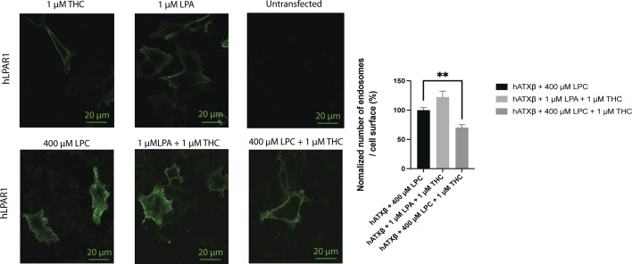 Control assays for LPA1 receptor internalization.No internalization was found using THC alone. LPA treatment of cells led to high LPA1 receptor internalization, in accordance with previously published results. LPA1 receptors were internalized in the presence of THC, providing evidence for a specific THC-mediated effect of the ATX-LPA signaling axis. Inhibition of ATX-LPA signaling by THC is not abolished in the presence of higher LPC concentration (400 µM LPC, P = 0.0068). Untransfected cells were not stained using primary and secondary antibodies, confirming the specificity of the labeling reagents used. Image analysis was performed with ImageJ using nine images per condition from three experimental replicates.