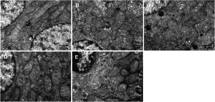 Mitochondrial ultrastructural changes in tubular epithelial cells. Representative pictures of Mitochondrial electron microscopy. a: NC; b: 4w CIH; c: 6w CIH; d: 4w CIH + Ri; e: 6w CIH + Ri. Original magnification, × 10,000. Scale bars, 1 μm