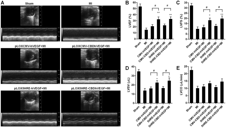 Evaluation of left ventricle function by echocardiography. (A) Representative images of M-mode echocardiography showing improved cardiac function in mice treated with lentivirus expressing hVEGF or CBDhVEGF compared with mice treated with control virus. (B–E) The left ventricular ejection fraction (LVEF), fractional shortening (LVFS), stroke volume (LVSV), and cardiac output (CO) were calculated by M-mode echocardiography in each group. Values are presented as mean ± SEM (n = 8 for each group). *p < 0.05, **p < 0.01, # p < 0.05.