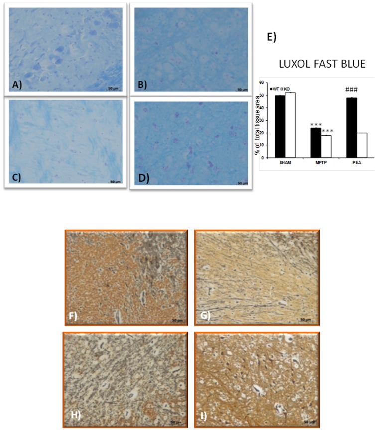 Effect of PEA on myelin structure and presence of granule-laden astrocytes (Gomori stains).In sham PPARαKO animals (A and E), myelin structure was clearly stained by Luxol fast. At 8 days after MPTP injection in PPARαWT mice (B and E), a significant loss of myelin was observed. Myelin degradation was further progressed in PPARαKO mice and myelin negative area was defined in SN (C and E). The treatment with PEA significantly restored in PPARαWT the myelin presence (D and E). In addition, in sham PPARαWT mice (data not shown) or sham PPARαKO mice (F) a significant presence of astrocytes exhibiting an affinity for chrome-alum hematoxylin and aldehyde fuchsin was observed in the SN as well as in the vessels. On the contrary, a significant alteration of the Gomori positive localization was observed in the SN from MPTP-injected PPARαWT mice (G). A more alteration of Gomori positive localization was observed in MPTP injected-PPARαKO mice (H). PEA treatment reduced the alteration of the Gomori positive localization in PPARαWT mice (I).
