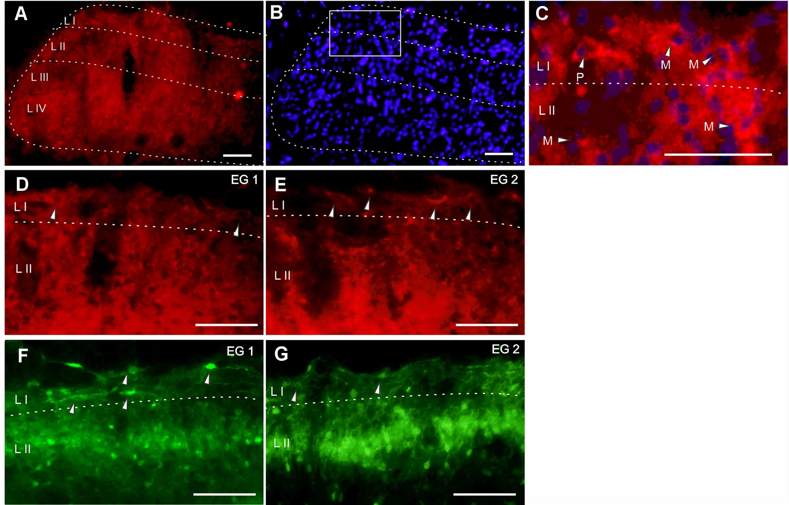 Coronal sections of the Vc using the immunofluorescence technique for CB1r (A) and fluorescent DNA marker Hoechst for cell nuclei labeling (B)Arrowhead in C indicate co-expression in projection (P) and modulatory (M) neurons LI and LII. Arrowheads indicate CB1r positive projection neurons (D and E) and calbindin D28K neurons (F and G) in the ipsilateral Vc of experimental groups. The bar graphs represent the number of positive projection neurons (G) and positive modulatory neurons (H) per area in LI or LII of each group. The scale bar represents 50 μm. * p<0.05