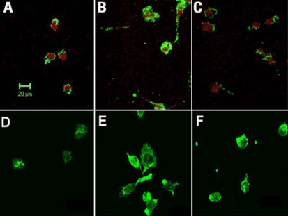 Effects of cannabidiol (CBD) on lipopolysaccharide (LPS)-induced morphological changes in rat retinal microglial cells. Confocal micrographs were made of cells identified by microglial- and macrophage-specific marker CD11b followed by Oregon green-conjugated secondary antibody. Cell nuclei were counter-stained by propidium iodide. A: Cells were cultured in serum-free medium for 12 h. B: Cells were treated with 30 ng/ml lipopolysaccharide in serum-free medium for 12 h. C: Cells were cannabidiol (CBD, 1 μM)-pretreated and lipopolysaccharide-treated for 12 h. D-F: Cells similarly treated were also stained with fluorescent phallotoxins for Filamentous actin distribution and cellular morphology. Scale bar represents 20 μm.