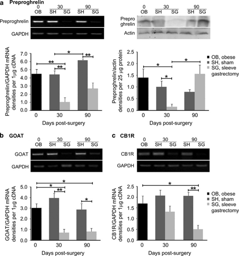 Regulation of the gastric ghrelin system by SG. (a) Sustained reduction of preproghrelin mRNA post SG (left panel); detection of the non secreted preproghrelin peptide levels exhibited a decrease only in the short term, whereas peptide levels recovered almost fully in the long term (right panel). mRNA levels analysis of (b) GOAT and (c) CB1R showed maintenance of low Mboat4 expression levels, in contrast to the decrease in CB1R mRNA expression, which reached significance at 90 days after SG as compared with sham-operated animals. Representative images of reverse transcription (RT) PCR and WB are illustrated on top of the respective graphs. The expression levels of the housekeeping markers GAPDH and actin were used to normalize the genes of interest expression levels for RT-PCR and WB, respectively. n=4–6 animals per group; *P< 0.05 and **P< 0.01.