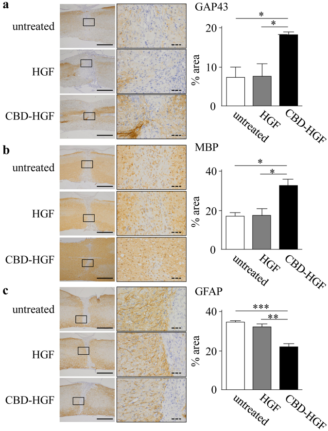 Axonal growth after spinal cord compression injury. Mice subjected to a compression injury were treated with a single administration of CBD-HGF or HGF. Untreated mice were used as controls (4 mice each per 3 groups). Immunohistochemistry for GAP43 (a), MBP (b) and GFAP (c) at the injury sites was performed 6 weeks post-injury. Left: Representative photographs from each group. The scale bar indicates 500 µm (solid line) and 50 µm (dotted line). Right: Immunopositive areas were measured under a microscope and percent area is shown. *p < 0.05, **p < 0.01, ***p < 0.001.