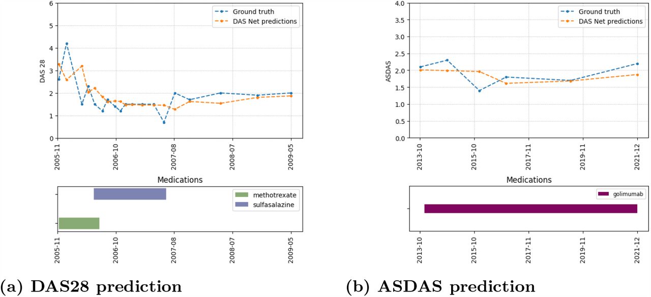 Predictions of individual patient trajectories.We compare the model predictions with the ground truth values of DAS28/ASDAS for two example patients. The bar charts show the prescribed medications present in the database.