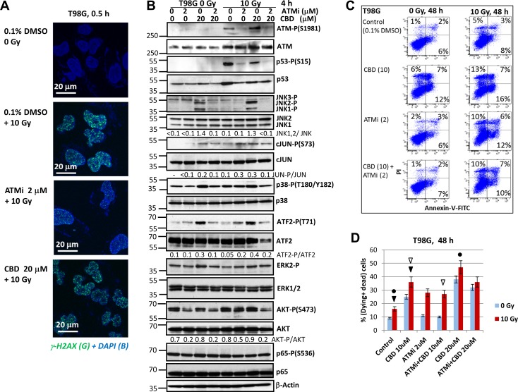 Changes in the pattern of cell signaling proteins of T98G human GBM cells and regulation of cell death after treatment with ATMi alone or in combination with CBD and γ-irradiation(A) DNA DSB were induced in the nuclei of treated T98G cells and detected by immunostaining with anti-γH2AX Ab (green foci) and DAPI staining of DNA (blue). (B) Western blot analysis of indicated signaling proteins from T98G cells was performed 4 h after treatments with CBD (10 μM), the ATMi KU60019 (2 μM), alone or in combination, without or with γ-irradiation (10 Gy). CBD, ATMi, and DMSO (a vehicle) were added to the cell cultures 30 min before irradiation. (C and D) Apoptotic levels in T98G cells were detected using Annexin-V-FITC and PI staining, as described in Figure 3A. A typical result (C) and the pooled results of four independent experiments are presented (D). Error bars represent means ± S.D. (p < 0.05, Student's t-test). The arrows and circles indicate significant differences in cell death levels between control cells and cells after specified treatments.