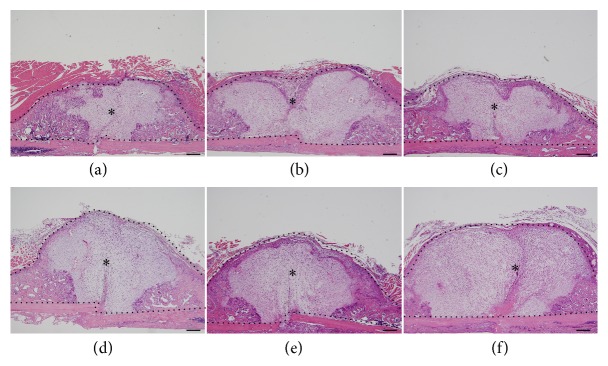 Representative hematoxylin and eosin-stained tissue sections at 2 weeks of fracture healing. Histological images of fractured mouse femurs treated with (a) PBS, (b) bFGF, (c) bFGF-s3, (d) bFGF-s2b-s3, (e) bFGF-s3b, and (f) bFGF-s3a-s3b after two weeks of recovery. Regions enclosed by black dotted lines (∗) in (a)–(f) indicate callused areas. Scale bar = 500 μm.