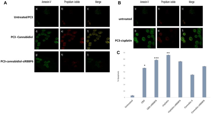 Morphological analysis of apoptosis in PC3 cells transfected with siRBBP6 and co- treated with CBD and cisplatin. PC3 cells were treated with CBD, CBD-siRBBP6, cisplatin and cisplatin-siRBBP6 for 48 h. A morphological apoptosis analysis of PC3 treated with CBD and CBD-siRBBP6 B morphological apoptosis analysis of PC3 treated with cisplatin and cisplatin- siRBBP6 C PC3 cells apoptosis analysis determined by flow cytometry. Results are expressed as the mean ± SEM of three independent experiments. *P < 0.05, **P < 0.01, and ***P < 0.001 vs. untreated
