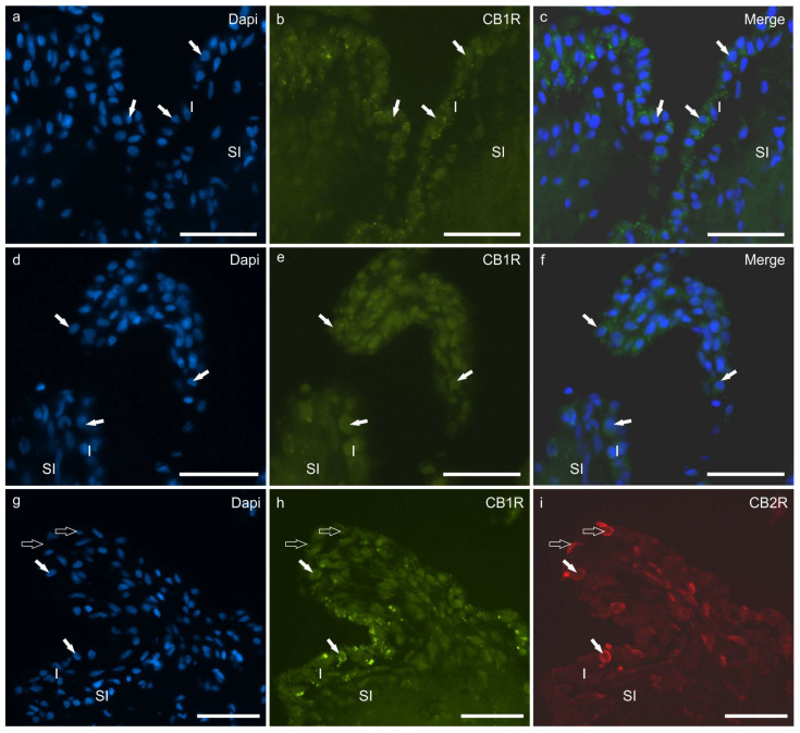 (a–f) Photomicrographs of cryosections of the synovial membrane of the hip (a–c) and stifle (d–f) joints of dogs showing immunoreactivity for the cannabinoid receptor type 1 (CB1R). The arrows indicate some synoviocytes showing faint CB1R immunoreactivity. (g–i) Photomicrographs of cryosections of the synovial membrane of the stifle joint of dog showing colocalisation between two antibodies directed against the cannabinoid receptor type 1 (CB1R) (h) and the cannabinoid receptor type 2 (CB2R) (i). The white arrows indicate two synoviocytes coexpressing CB1R and CB2R immunoreactivity. The open arrows indicate two synoviocytes which were immunoreactive only for the CB2R. Abbreviations: I, intima; SI, subintima. Bar: 50 µm.