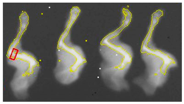 Example of humerus bone distal region dual-energy X-ray absorptiometry analysis. Mouse dissected left forelimbs were scanned in groups of n = 4. Images were adjusted for high contrast. A small ROI (red box) was placed at the distal end of the humerus bone in the approximate region where bone densities and epiphyseal plate thickness were measured. Site-specific BMC and BMD were then analyzed.