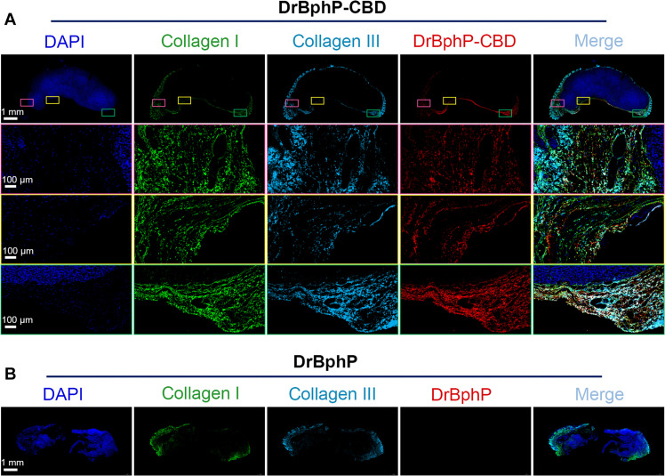 Immunofluorescence images depicting MC38 tumor sections with binding of DrBphP-CBD or DrBphP.Sections are counterstained with 4′,6-diamidino-2-phenylindole (DAPI) for nuclear visualization. The top displays whole tumor views, while the bottom offers zoomed-in perspectives of the designated areas in the top, showcasing detailed binding interactions for DrBphP-CBD (A) and DrBphP (B).