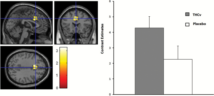 Left: Chocolate sight. Increased anterior cingulate activation under tetrahydrocannabivarin (THCv) compared with placebo, small volume corrected (svc) (z=3.19, P=.03 svc family wise error [FWE]-corrected for multiple comparisons). Right: Contrast estimates for anterior cingulate centered at −2 20 36 for chocolate sight. Error bars show 1 SEM.