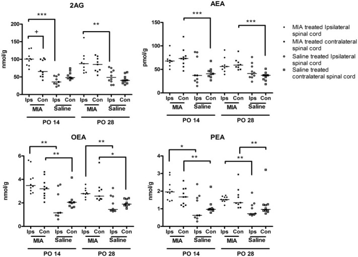 Levels of endocannabinoids (2-arachidonyl glycerol [2-AG] and anandamide [AEA]) and related N-acylethanolamines (oleoylethanolamide [OEA] and palmitoylethanolamide [PEA]) in the spinal cords of rats treated with mono-iodoacetate (MIA; 1 mg) or saline, 14 and 28 days following intraarticular injection of MIA. Bars show the median. + and ∗ = P < 0.05; ∗∗ = P < 0.01; ∗∗∗ = P < 0.001, by Mann-Whitney test. Ips = ipsilateral; Con = contralateral; PO = postoperative day.