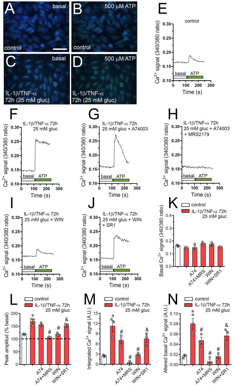 High glucose and IL-1β/TNF-α enhance ATP-dependent Ca2+ dynamics in endothelial cells: prevention by WIN. (A–D) Representative photomicrographs of basal (A,C) or 500 µM ATP-induced (B,D) Ca2+ signal denoted as Fura-2 ratio (340/380 nm excitation) of EAhy cells treated for 72 h with 5 mM glucose [control (A,B)] or 25 mM glucose and IL-1β/TNF-α (C,D). Calibration bar: 180 µm. (E–J) Representative plots of relative changes in [Ca2+]i signal over time induced by 500 µM ATP (gray vertical line) in EAhy cells treated for 72 h with 5 mM glucose [control (E)], 25 mM glucose, and IL-1β/TNF-α (F) alone or in combination with the following agents: 10 µM A740003 (G), 10 µM A740003 plus 10 µM MRS2179 (H), 5 µM, WIN (I) and 5 µM, WIN plus 5 µM SR-141716A [SR1 (J)]. (K) Averaged data of basal Fura-2 ratio by EAhy cells treated for 72 h with 5 mM glucose (control, white bar), 25 mM glucose, and IL-1β/TNF-α (red bars) alone or in combination with the following agents: 10 µM A740003 (A74), 10 µM A740003 plus 10 µM MRS2179 (A74 + MRS), 5 µM WIN (WIN) and 5 µM, WIN plus 5 µM SR-141716A (WIN + SR1). (L–N) Averaged data of ATP-induced peak amplitude normalized to basal Fura-2 ratio (L), integrated ATP-induced Fura-2 ratio response (M), and altered basal Fura-2 ratio (N) of EAhy cells treated for 72 h with 5 mM glucose (control, white bar), 25 mM glucose, and IL-1β/TNF-α (red bars) alone or in combination with the following agents: 10 µM A740003 (A74), 10 µM A740003 plus 10 µM MRS2179 (A74 + MRS), 5 µM WIN (WIN) and 5 µM, WIN plus 5 µM SR-141716A (WIN + SR1). *p < 0.05, IL-1β/TNF-α and high glucose compared to control; #p < 0.05, effect of each pharmacological agent compared to the effect induced by IL-1β/TNF-α and high glucose; &p < 0.05, effect of each cannabinoid receptor antagonist compared to the effect of the respective cannabinoid (one-way analysis of variance followed by Tukey’s post hoc test). Data were obtained from at least three independent experiments (see scatter dot plot) with four repeats each one (≥35 cells analyzed for each repeat).