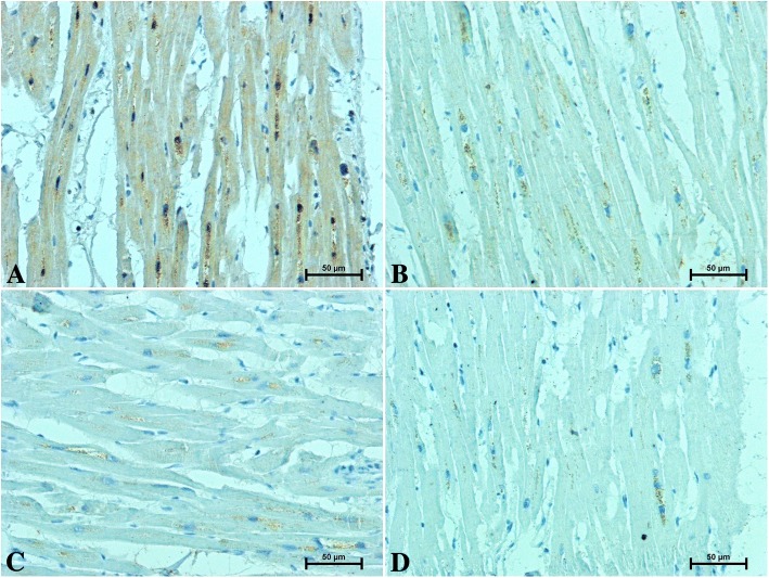 Immunolocalization of the CB2 receptor in the heart of patients under 50 years old a men b women and over 50 years old c men d women