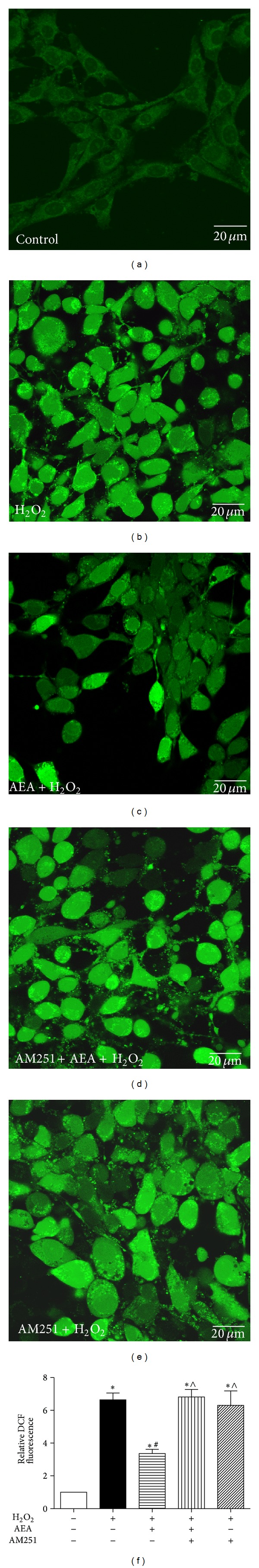 AEA decreased intracellular ROS generation via CB1. The intracellular ROS levels were assessed by ROS reagent kit. (a)–(e) indicate the fluorescence intensity of ROS. (a) Control cells cultured in drug-free medium. (b) Cells exposed to 200 μM H2O2 for 3 h. (c) Cells exposed to 10 μM AEA plus 200 μM H2O2 for 3 h. (d) Cells exposed to 10 μM AEA plus 10 μM AM251 in the presence of 200 μM H2O2 for 3 h. (e) Cells exposed to 10 μM CB1 antagonist AM251 plus 200 μM H2O2 for 3 h. (f) Statistical results of (a)–(e). Results are expressed as means ± SD (n = 6). *P < 0.05 versus the control (no H2O2, no AEA, and no AM251), # P < 0.05 versus the cells exposed to H2O2 alone, and ∧ P < 0.05 versus the cells exposed to AEA plus H2O2.