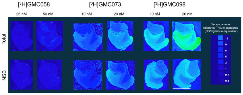 Representative images from a pilot autoradiography experiment on post-mortem sections from the cingulate cortex of one healthy human subject. Testing specific binding of: [3H]GMC-058: 25 nm, 50 nM; [3H]GMC-073: 10 nM, 20 nM; [3H]GMC-098: 10 nM, 20 nM. Non-specific binding (NSB) was measured with excess (5 µM) of blocker GMC044. GMC044 displaced ~65% of [3H]GMC-058 binding and ~50% of [3H]GMC-073 and [3H]GMC-078. Line scale: 10 mm.