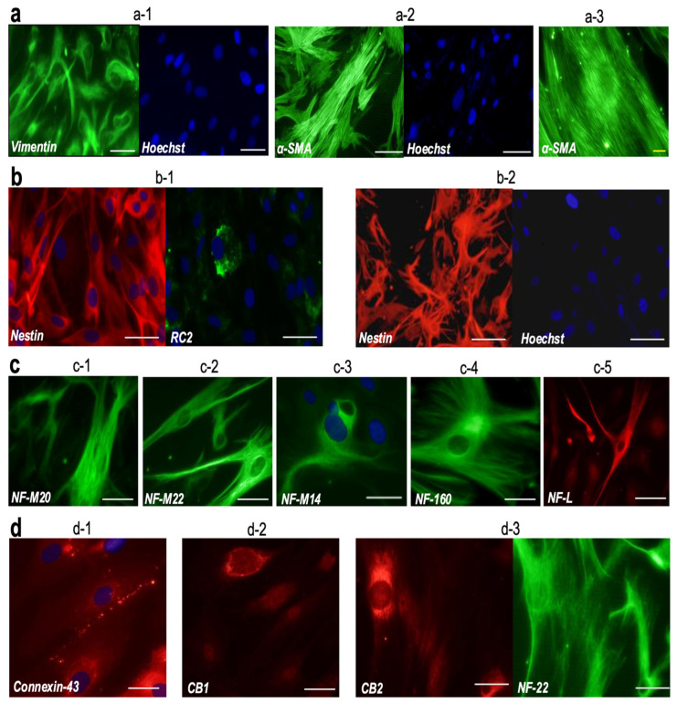 Immunocytochemical characterization of grade 1 meningioma cultures H8T-MG and H16T-MG. (a–d) Representative immunostainings for vimentin, α-SMA, nestin, RC2, neurofilament subunits (NF-M20, NF-M22, NF-M14, NF-160, NF-L), connexin-43, CB1 and CB2. H8T-MG images correspond to panels (a-1,a-2,b-1,c-2,c-4,c-5,d-3); H16T-MG images correspond to panels (a-3,b-2,c-1,c-3,d-1,d-2). All markers were detected in both cultures; only representative images are shown. White scale bars: 50 µm. Yellow scale bars: 15 µm.
