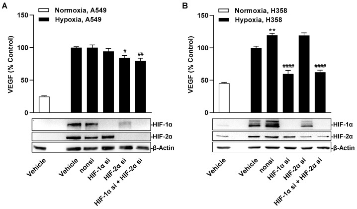 Effect of specific siRNA against HIF-1α and HIF-2α, alone or in combination, on hypoxia-induced VEGF secretion in A549 (A) or H358 cells (B). Cells were transfected with either non-silencing siRNA (nonsi), HIF-1α- or HIF-2α siRNA for 24 h. Cells were then washed and incubated in serum-free DMEM. After incubation for 48 h, CM were collected and VEGF protein concentrations were determined by ELISA. Monitoring of HIF-1α and HIF-2α protein knockdown was confirmed in parallel with lysates from hypoxic A549 and H358 cells by Western blots after 3 h, 24 h, and 48 h of hypoxia, with the Western blot images shown being representative of the 3 h time point. All percentage values given refer to vehicle-treated hypoxic A549 or H358 cells, each set to 100%. A vehicle-treated normoxic cell group was included to define the hypoxia effect. Data represent mean ± SEM of n = 12. ** p ≤ 0.01 vs. vehicle-treated hypoxic cells; # p ≤ 0.05, ## p ≤ 0.01, #### p ≤ 0.0001 vs. non-silencing siRNA-treated hypoxic cells; one-way ANOVA with Bonferroni´s post hoc test.