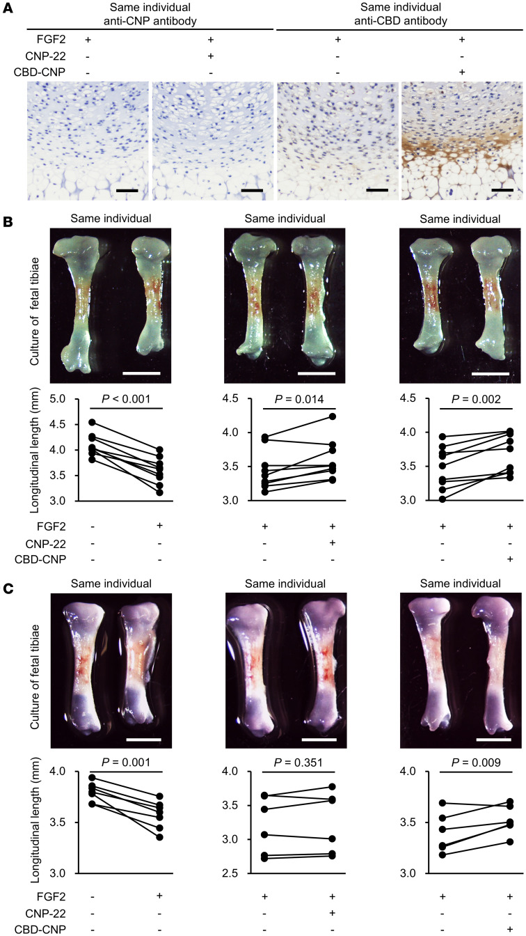 Bone growth effect of CBD-CNP in ex vivo bone culture.(A) Representative DAB staining images of fetal murine tibiae (E16.5, FVB background) treated with FGF2 in the presence of CNP-22 or CBD-CNP with daily medium changes. CNP-22 was detected with anti-CNP antibody, and CBD-CNP was detected with anti-CBD antibody. (B) Fetal murine tibiae were cultured and treated with FGF2 in the presence of CNP-22 or CBD-CNP with daily medium changes. After 4 days, the tibial lengths were measured and compared with those of contralateral untreated tibiae in the same patients (n = 9). (C) To assess the prolonged effects, only a single administration of CNP-22 or CBD-CNP was performed on the first day, whereas FGF2 was added daily. The tibial lengths were measured after 4 days from the first dosage (n = 7 in FGF2 and CBD-CNP groups, and n = 6 in CNP-22 group). Scale bars: 50 μm in A; 1 mm in B and C. The tibial lengths within patients were compared using a paired t test. DAB, 3,3′-diaminobenzidine.