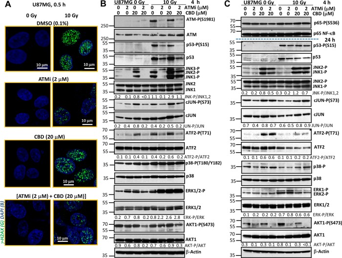 Effects of ATM kinase inhibition on radiation response of U87MG GBM cells(A) Effects of γ-irradiation (10 Gy), alone or together with cannabidiol (CBD, 10 μM in 0.1% DMSO), the ATM kinase inhibitor (ATMi) KU60019 (2 μM) in 0.1% DMSO on induction of DNA DSB in the nuclei of U87MG cells 0.5 h after treatment. DSB foci formation was determined using immunostaining with anti-H2AX-P-(S139) Ab (green) and DAPI staining of DNA (blue) that was followed by confocal microscopy. Bar = 10 μm. (B and C) Changes in the patterns of signaling proteins after treatment of U87MG cells with ATMi (2 μM) and CBD (20 μM), alone or in combination, followed by γ-irradiation at 10 Gy. CBD, ATMi and 0.1% DMSO (vehicle) were added to the cell cultures 30 min before irradiation. Western blot analysis of indicated signaling proteins from U87MG cells was performed 4 h and 24 h after treatments.